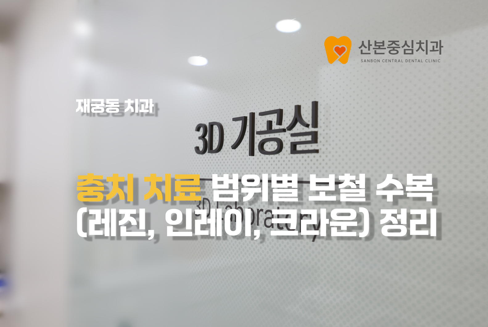 재궁동치과 충치 치료 범위별 보철 수복 안내 – 산본중심치과