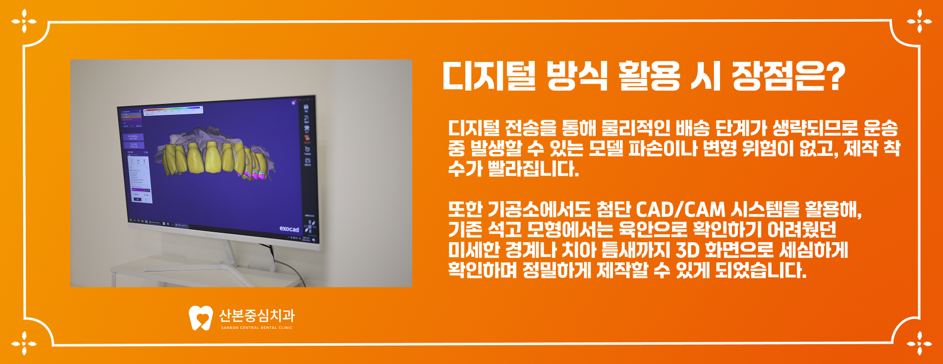 디지털 CAD/CAM 보철 설계 화면 - 궁내동 치과