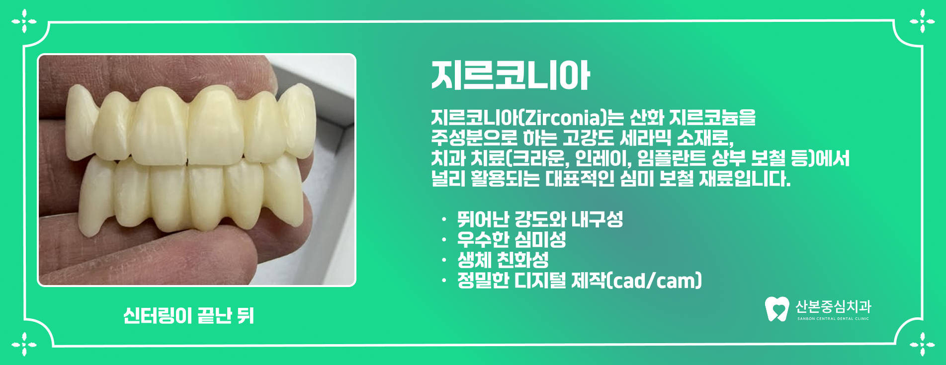 재궁동치과 지르코니아 크라운 – 산본중심치과