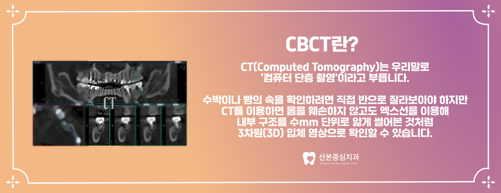 광정동치과 3D CBCT 검사 안내 – 산본중심치과