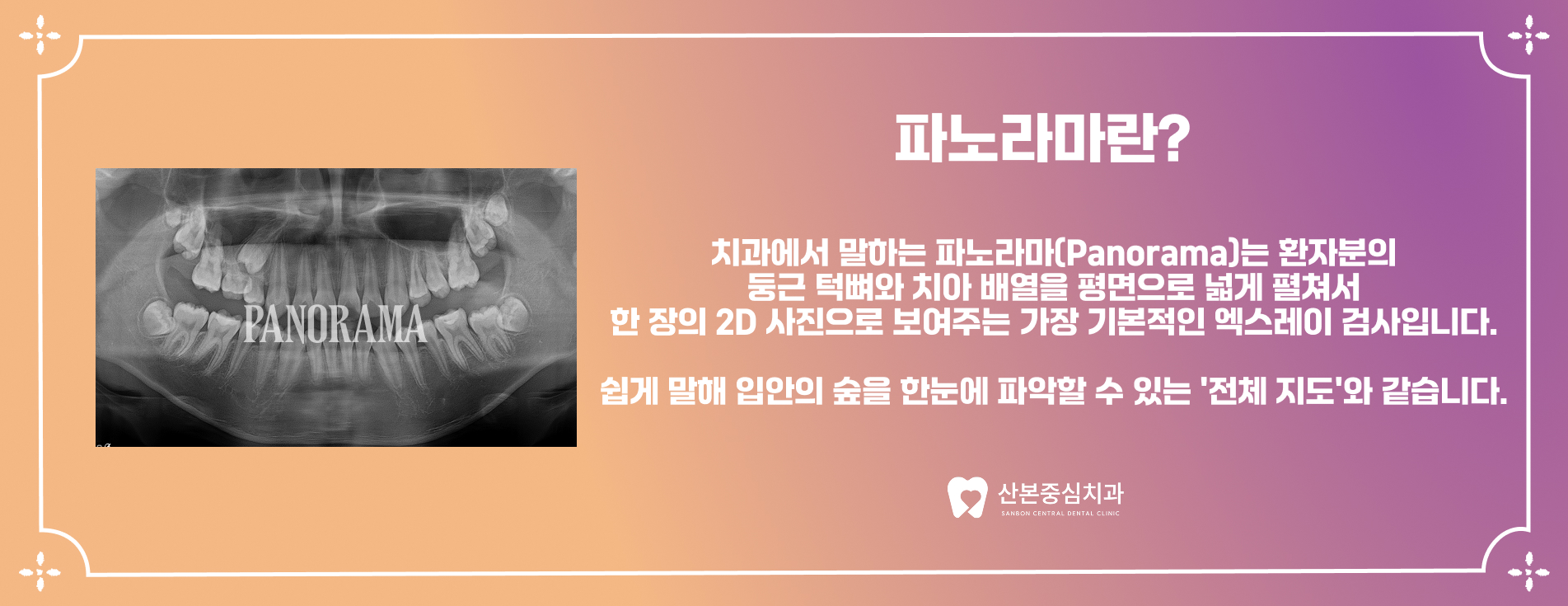 광정동치과 파노라마 검사 안내 – 산본중심치과