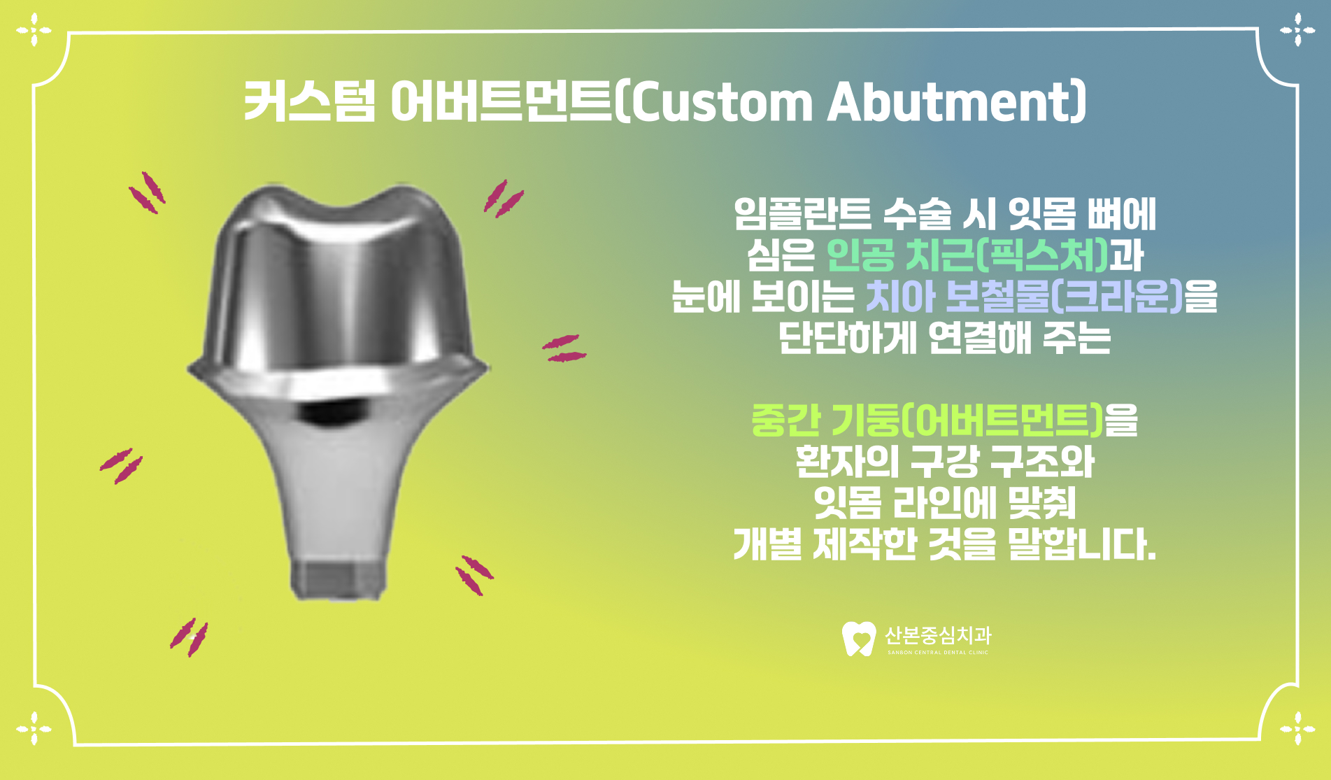 산본역치과 커스텀 어버트먼트 맞춤형 지대주란 – 산본중심치과
