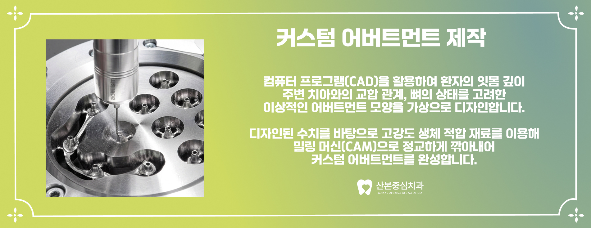 산본역치과 커스텀 어버트먼트 제작 과정 – 산본중심치과